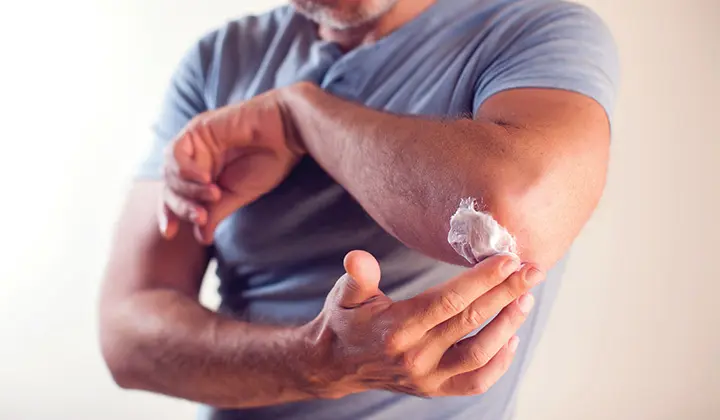 Ekzem als Hautentzündung