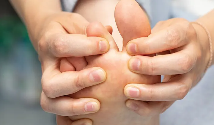 Hautpilz-Symptome zwischen den Zehen erkennen